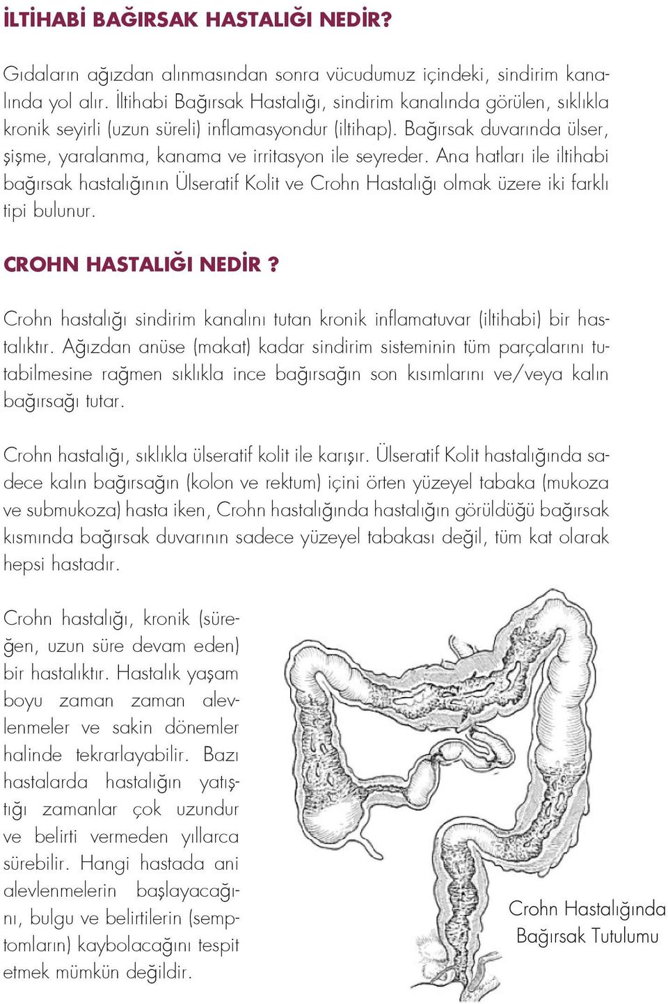 Ana hatları ile iltihabi bağırsak hastalığının Ülseratif Kolit ve Crohn Hastalığı olmak üzere iki farklı tipi bulunur. CROHN HASTALIĞI NEDİR?