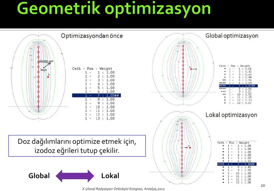 çekilir. Global Lokal X.