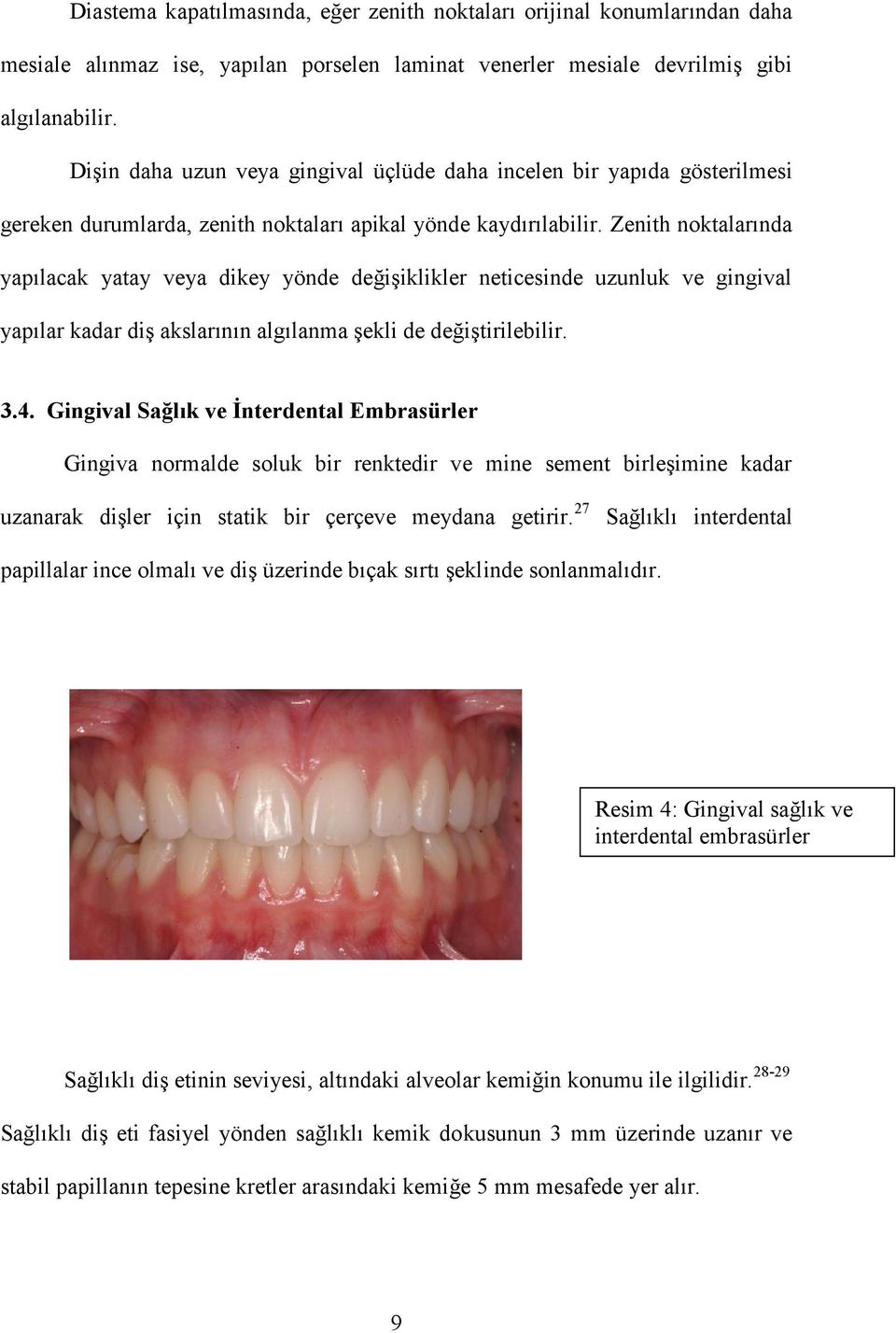 Zenith noktalarında yapılacak yatay veya dikey yönde değişiklikler neticesinde uzunluk ve gingival yapılar kadar diş akslarının algılanma şekli de değiştirilebilir. 3.4.