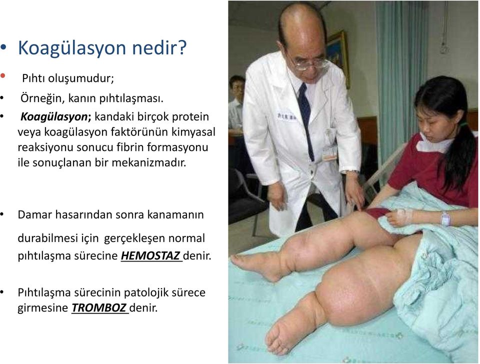 fibrin formasyonu ile sonuçlanan bir mekanizmadır.