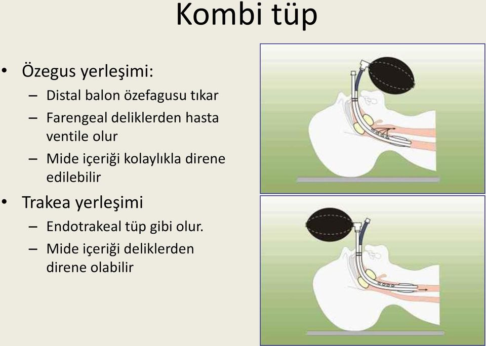 içeriği kolaylıkla direne edilebilir Trakea yerleşimi