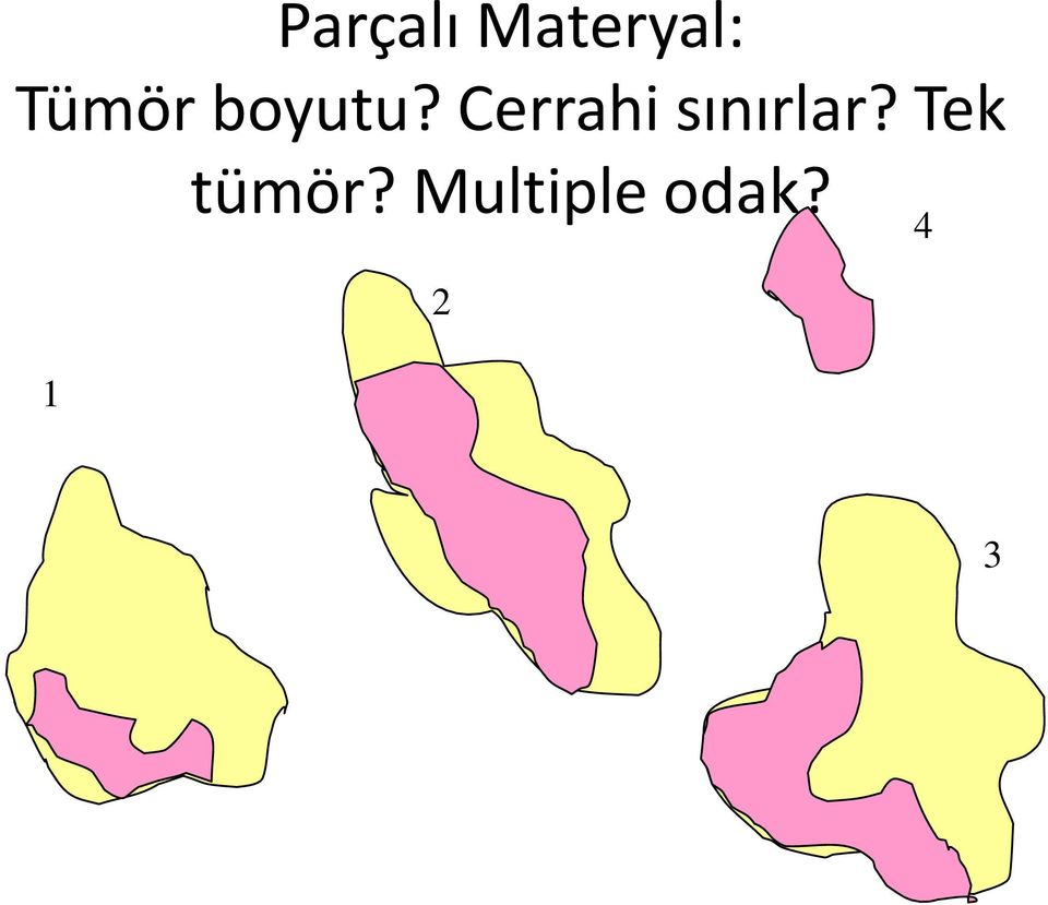 Cerrahi sınırlar?