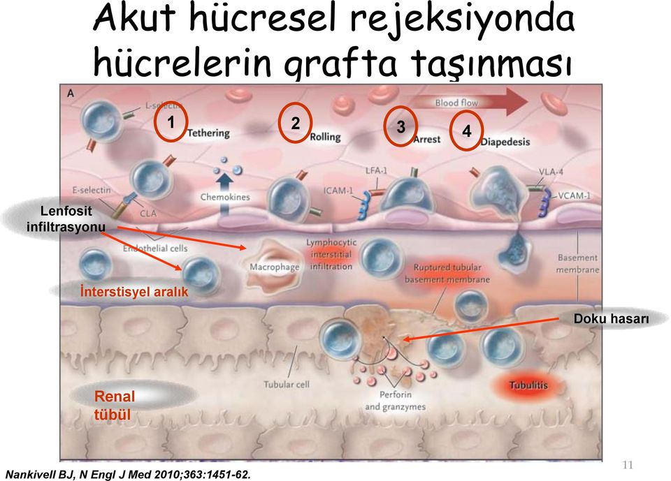 İnterstisyel aralık Doku hasarı Renal tübül