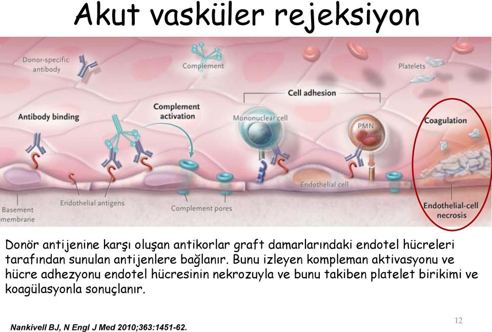 Bunu izleyen kompleman aktivasyonu ve hücre adhezyonu endotel hücresinin nekrozuyla