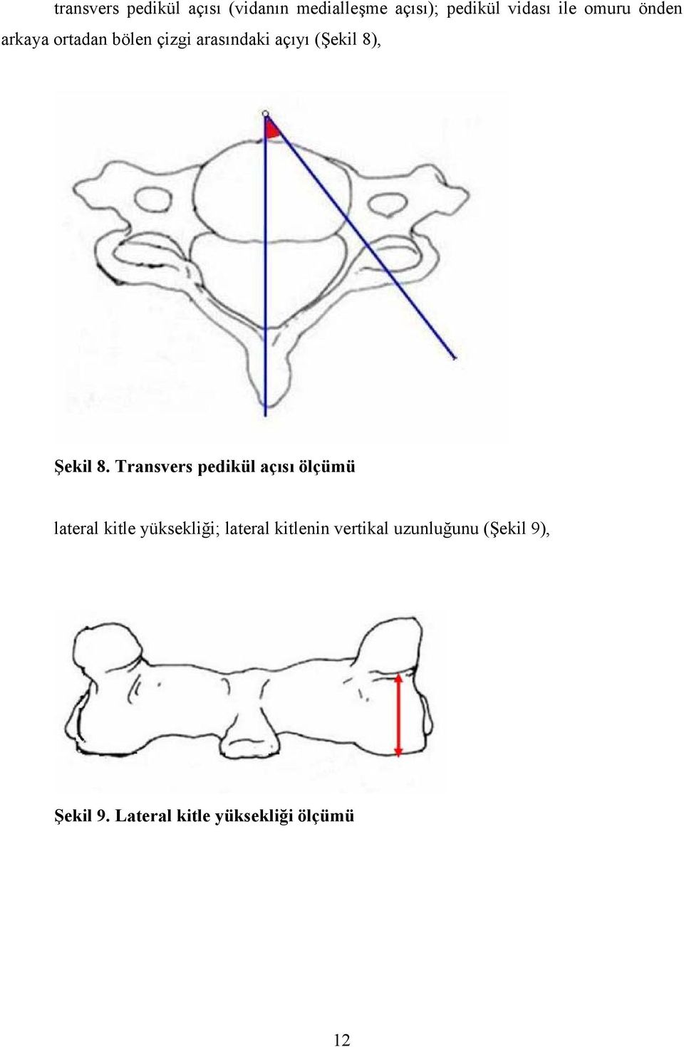 8. Transvers pedikül açısı ölçümü lateral kitle yüksekliği; lateral