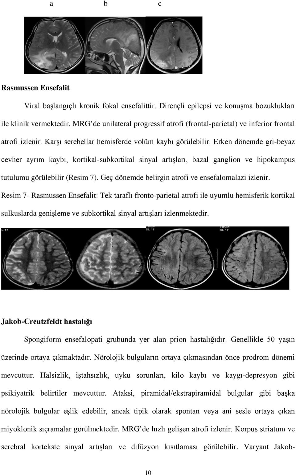 Erken dönemde gri-beyaz cevher ayrım kaybı, kortikal-subkortikal sinyal artışları, bazal ganglion ve hipokampus tutulumu görülebilir (Resim 7). Geç dönemde belirgin atrofi ve ensefalomalazi izlenir.