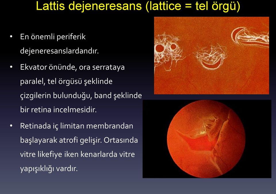 Ekvator önünde, ora serrataya paralel, tel örgüsü şeklinde çizgilerin bulunduğu,