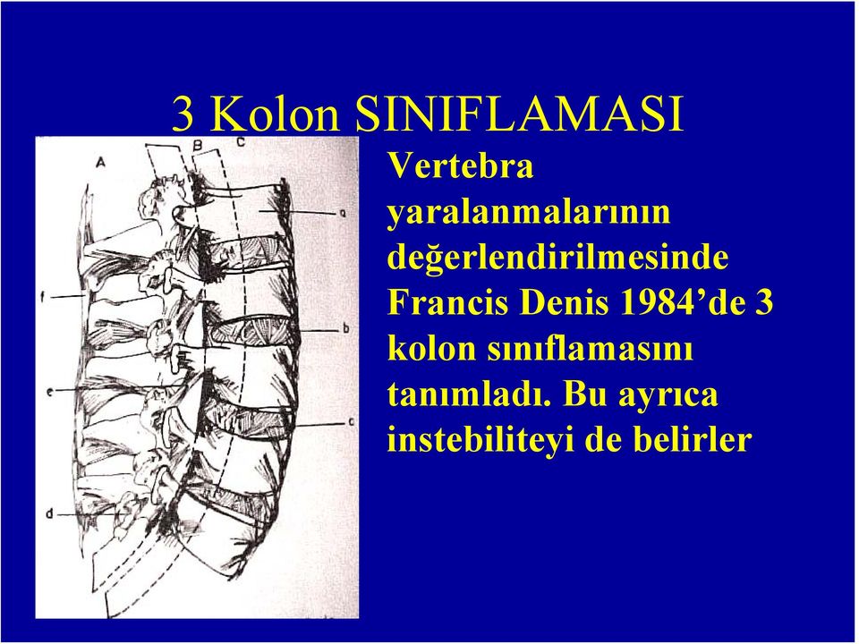 Francis Denis 1984 de 3 kolon