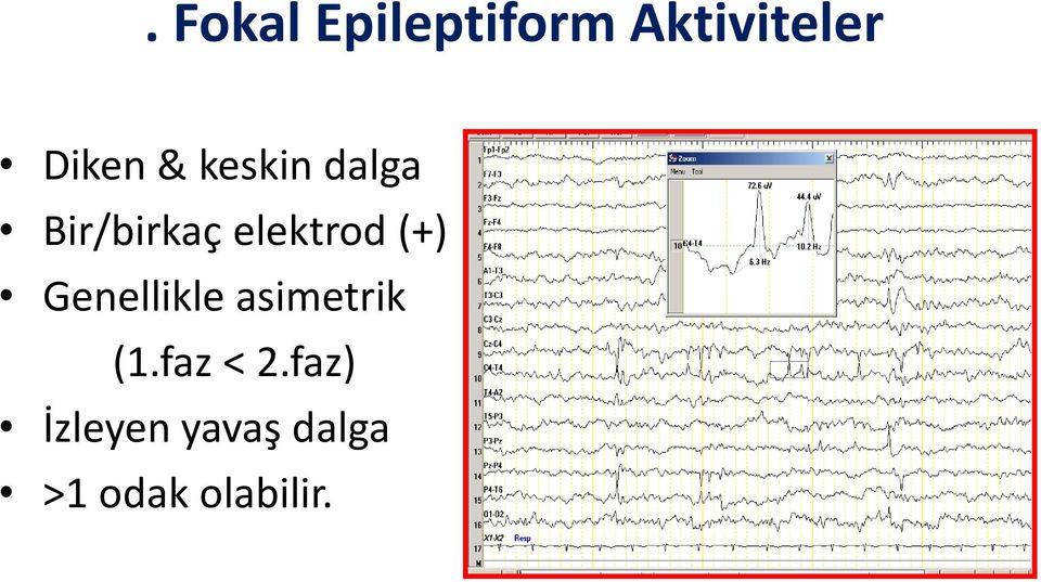 elektrod (+) Genellikle asimetrik (1.