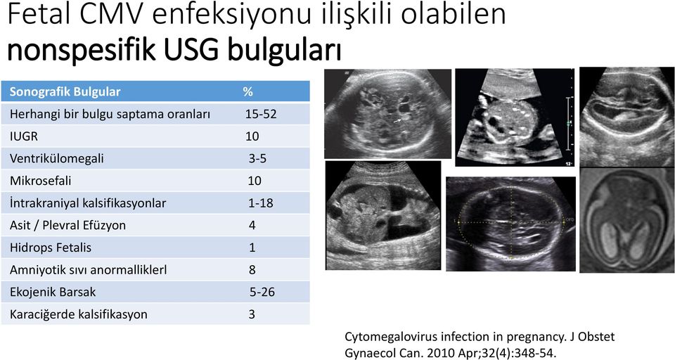 1-18 Asit / Plevral Efüzyon 4 Hidrops Fetalis 1 Amniyotik sıvı anormalliklerl 8 Ekojenik Barsak 5-26