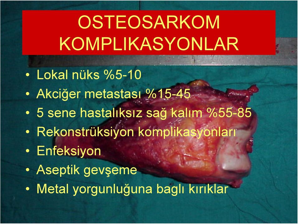 kalım %55-85 Rekonstrüksiyon komplikasyonları