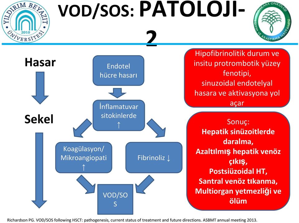 fenotipi, sinuzoidal endotelyal hasara ve aktivasyona yol açar Sonuç: Hepatik sinüzoitlerde