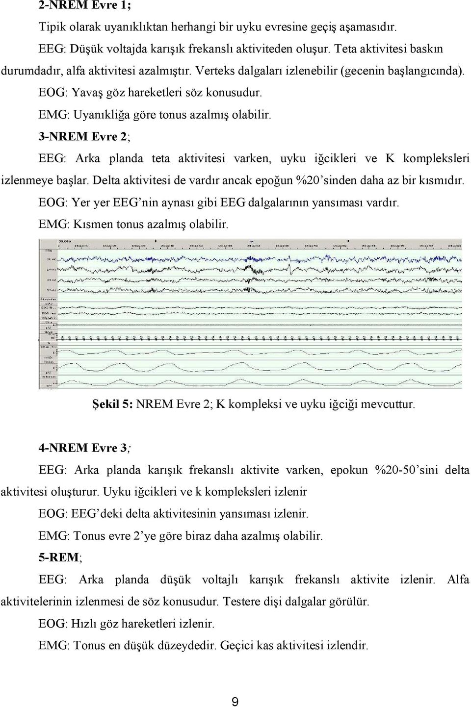 EMG: Uyanıkliğa göre tonus azalmış olabilir. 3-NREM Evre 2; EEG: Arka planda teta aktivitesi varken, uyku iğcikleri ve K kompleksleri izlenmeye başlar.