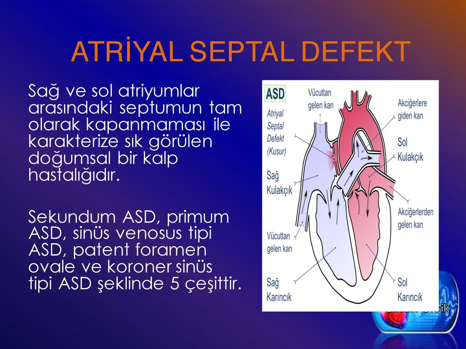 kalp hastalığıdır.