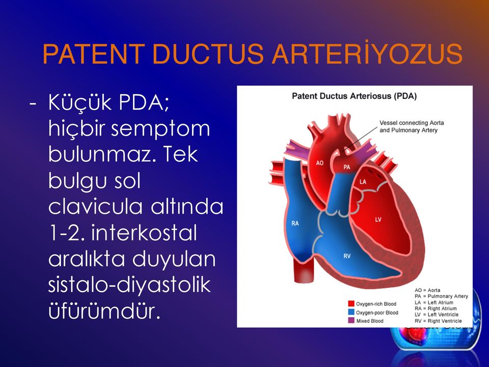 Tek bulgu sol clavicula altında 1-2.