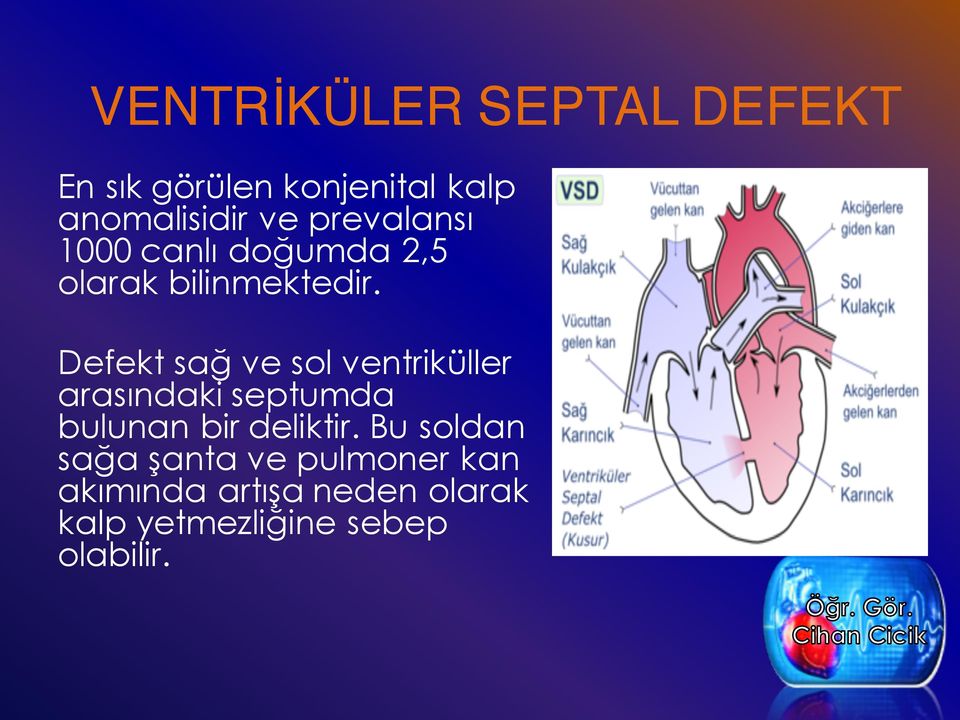 Defekt sağ ve sol ventriküller arasındaki septumda bulunan bir deliktir.