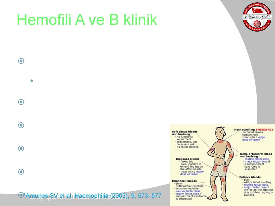 Kompartman sendromu Hematomlar: Havayolu basısı, hemorajik şok GİS kanama,