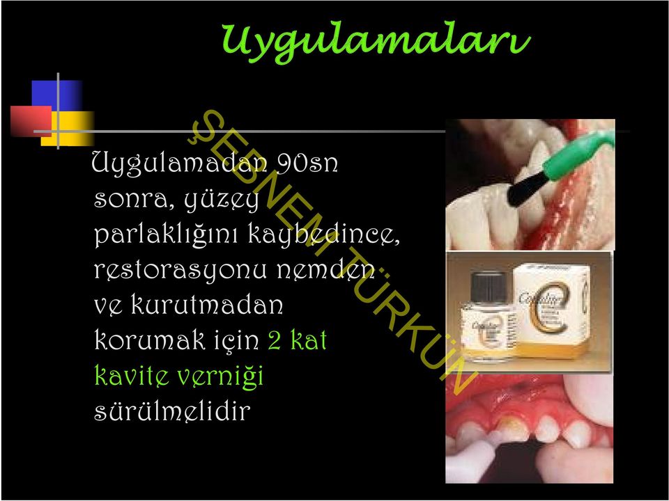 restorasyonu nemden ve kurutmadan