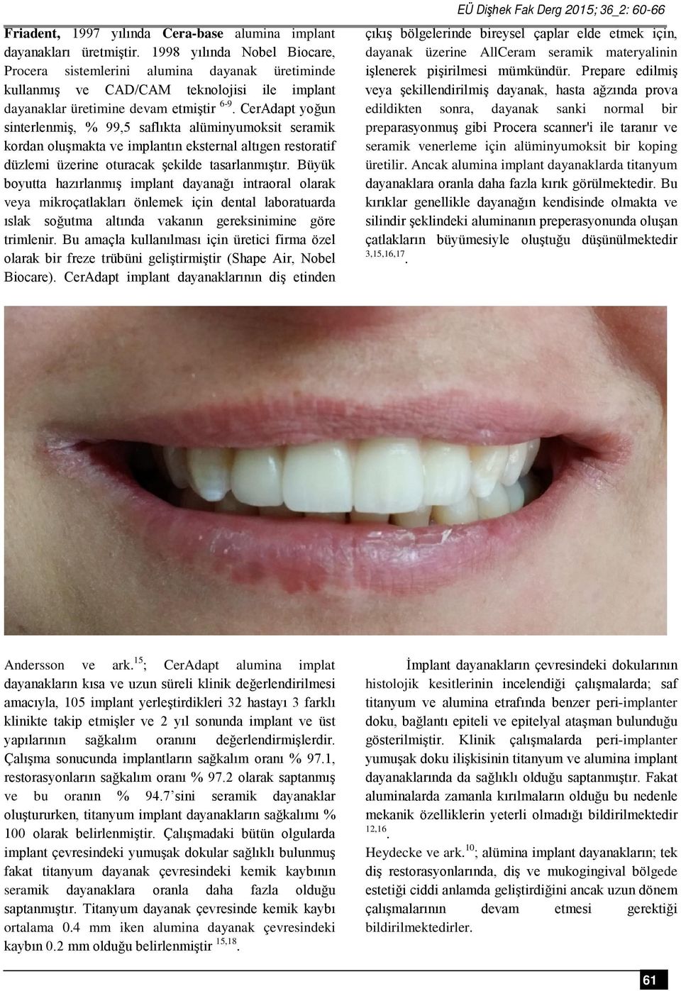 CerAdapt yoğun sinterlenmiş, % 99,5 saflıkta alüminyumoksit seramik kordan oluşmakta ve implantın eksternal altıgen restoratif düzlemi üzerine oturacak şekilde tasarlanmıştır.