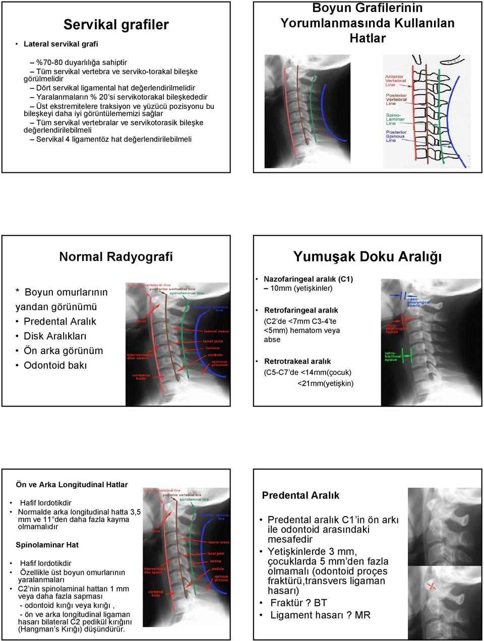 vertebralar ve servikotorasik bileşke değerlendirilebilmeli Servikal 4 ligamentöz hat değerlendirilebilmeli Normal Radyografi * Boyun omurlarının yandan görünümü Predental Aralık Disk Aralıkları Ön