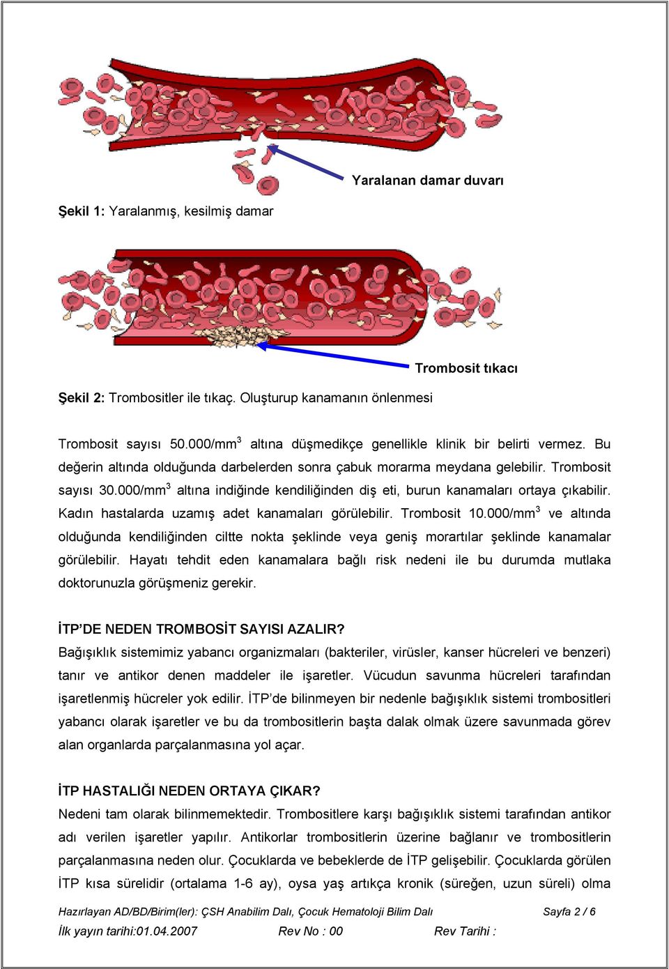 000/mm 3 altına indiğinde kendiliğinden diş eti, burun kanamaları ortaya çıkabilir. Kadın hastalarda uzamış adet kanamaları görülebilir. Trombosit 10.