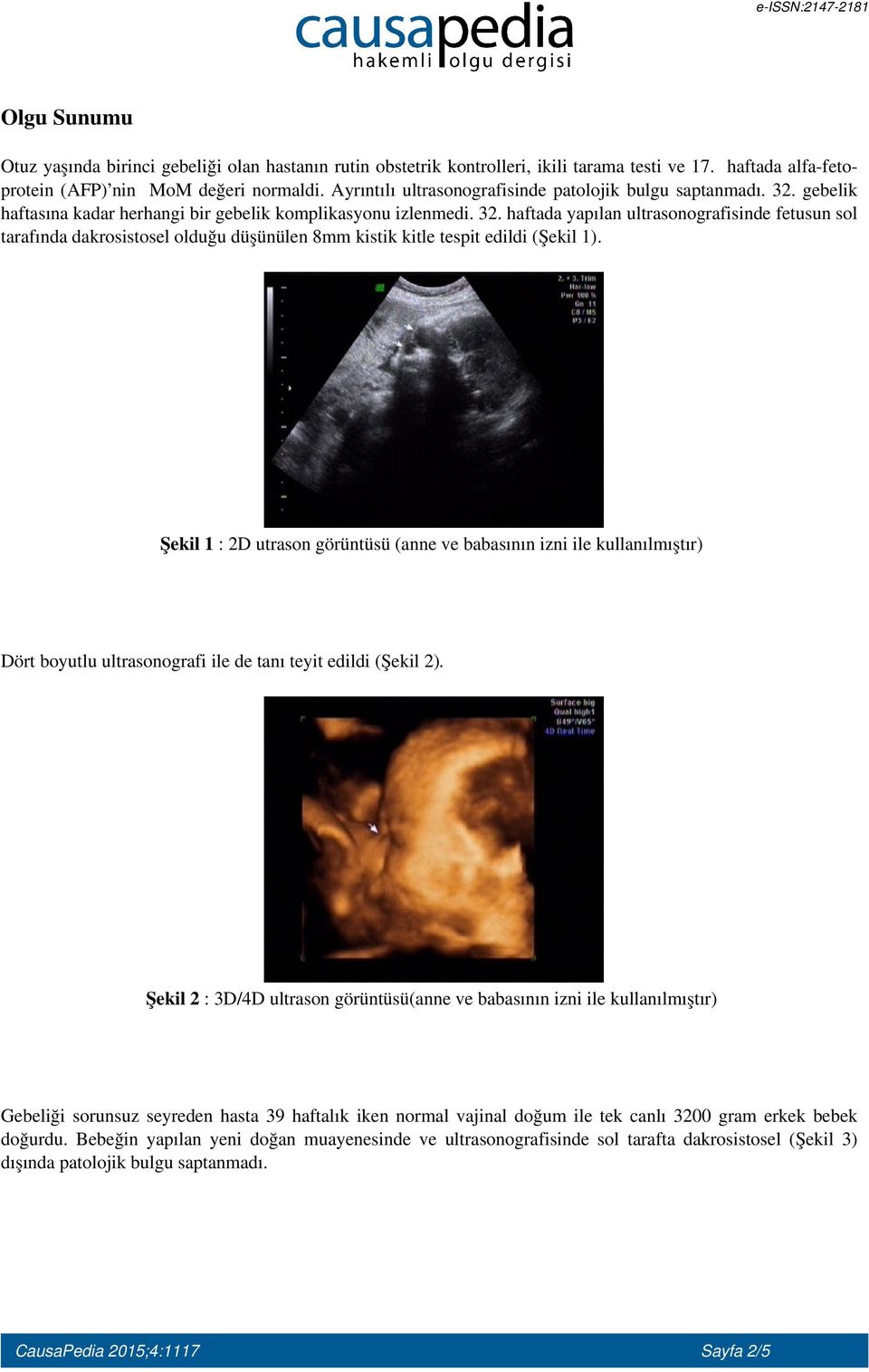 Şekil 1 : 2D utrason görüntüsü (anne ve babasının izni ile kullanılmıştır) Dört boyutlu ultrasonografi ile de tanı teyit edildi (Şekil 2).