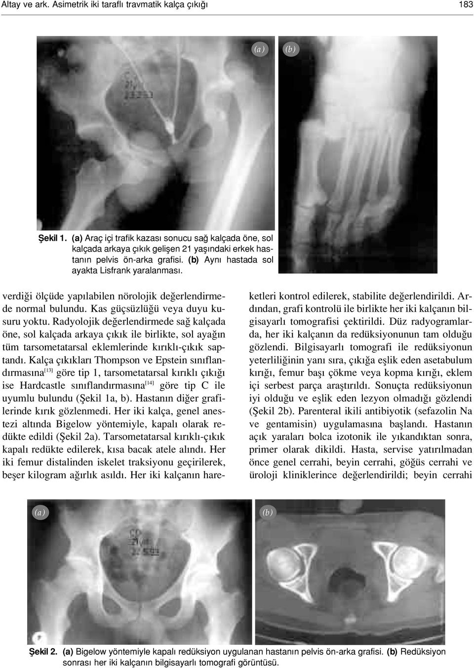 verdi i ölçüde yap labilen nörolojik de erlendirmede normal bulundu. Kas güçsüzlü ü veya duyu kusuru yoktu.