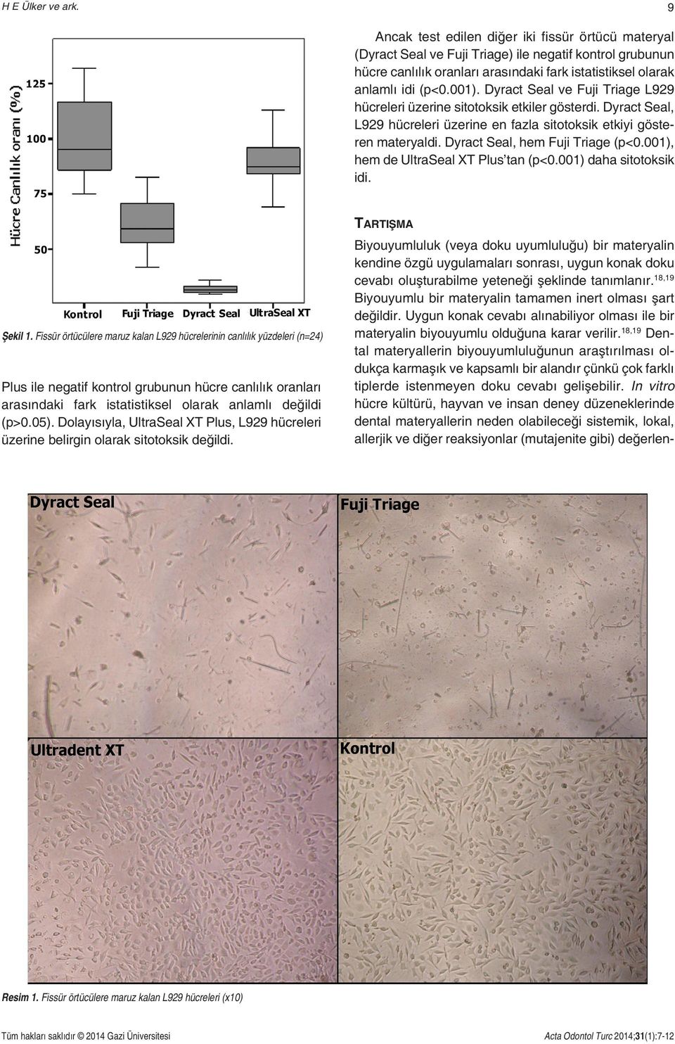 Dyract Seal ve Fuji Triage L929 hücreleri üzerine sitotoksik etkiler gösterdi. Dyract Seal, L929 hücreleri üzerine en fazla sitotoksik etkiyi gösteren materyaldi. Dyract Seal, hem Fuji Triage (p<0.