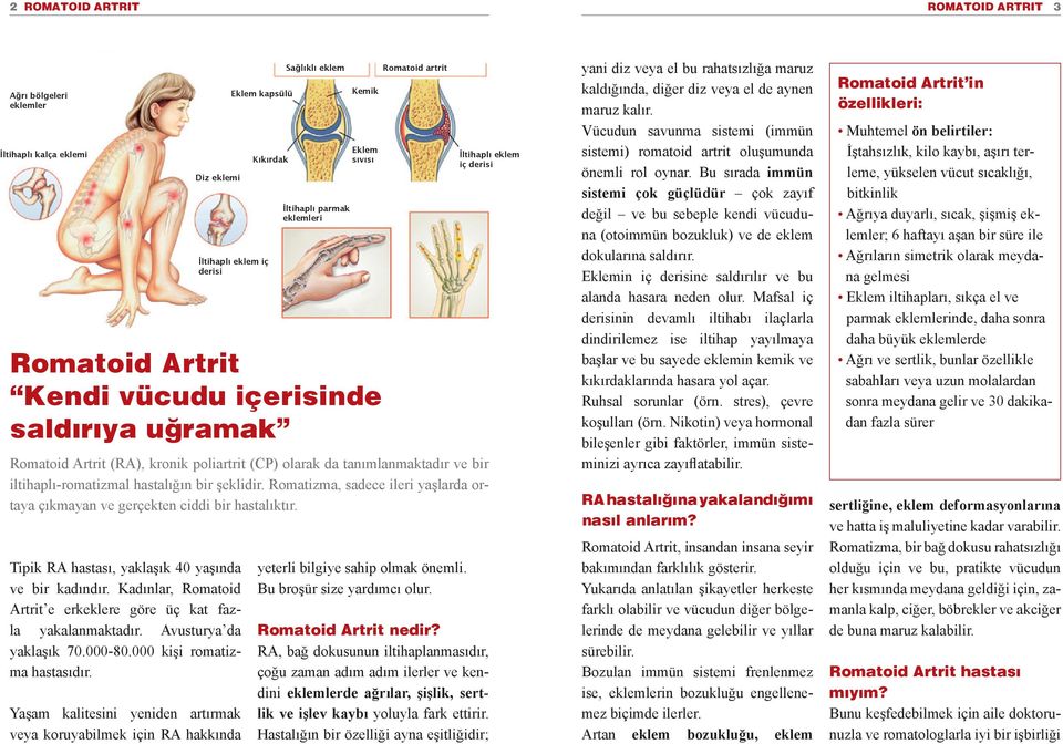 Yaşam kalitesini yeniden artırmak veya koruyabilmek için RA hakkında Eklem kapsülü İltihaplı eklem iç derisi Kıkırdak Sağlıklı eklem İltihaplı parmak eklemleri Kemik Eklem sıvısı Romatoid Artrit