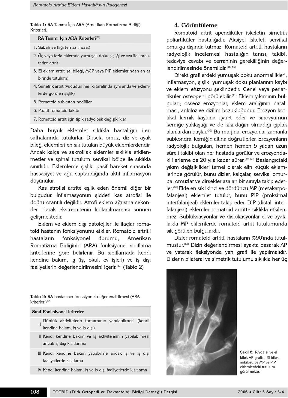 Simetrik artrit (vücudun her iki tarafýnda ayný anda ve eklemlerde görülen þiþlik) 5. Romatoid subkutan nodüller 6. Pozitif romatoid faktör 7.