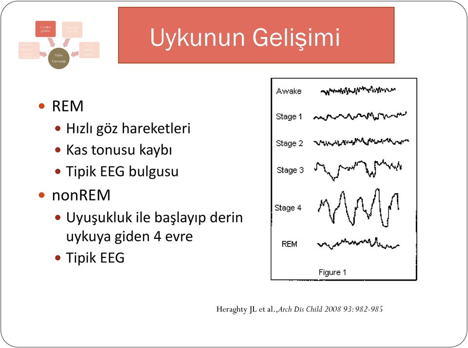 hareketleri Kas tonusu kaybı Tipik EEG bulgusu nonrem Uyuşukluk ile başlayıp