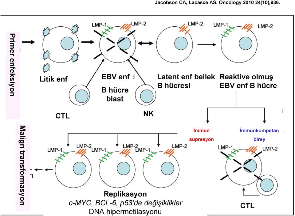 hücresi Reaktive olmuş EBV enf B hücre CTL NK Malign transformasyon