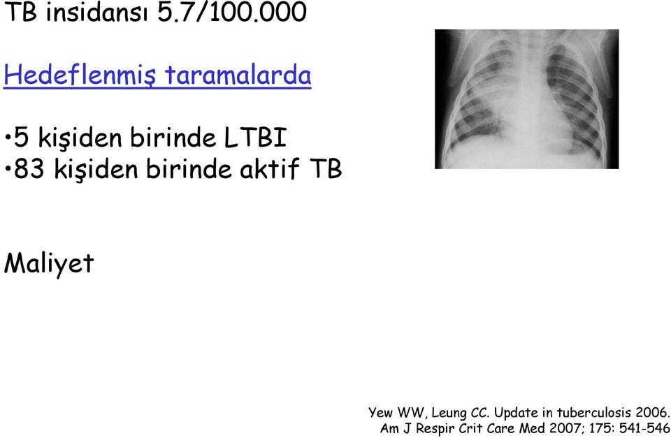 LTBI 83 kişiden birinde aktif TB Maliyet Yew WW,