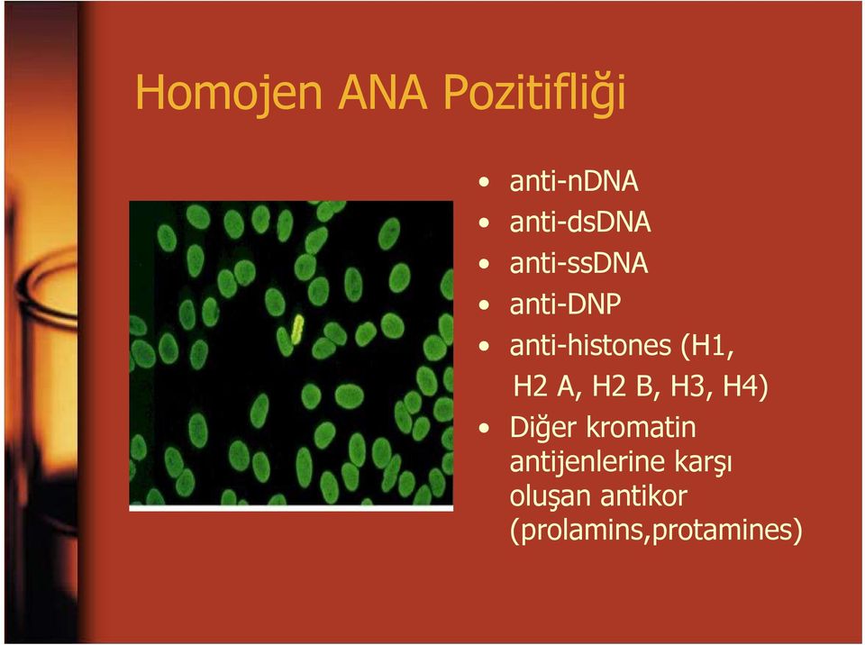 anti-histones (H1, H2 A, H2 B, H3, H4)