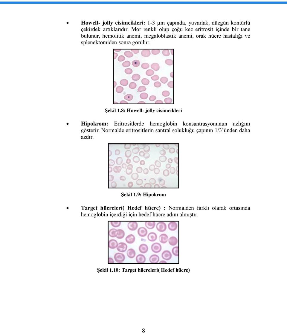 ġekil 1.8: Howell- jolly cisimcikleri Hipokrom: Eritrositlerde hemoglobin konsantrasyonunun azlığını gösterir.