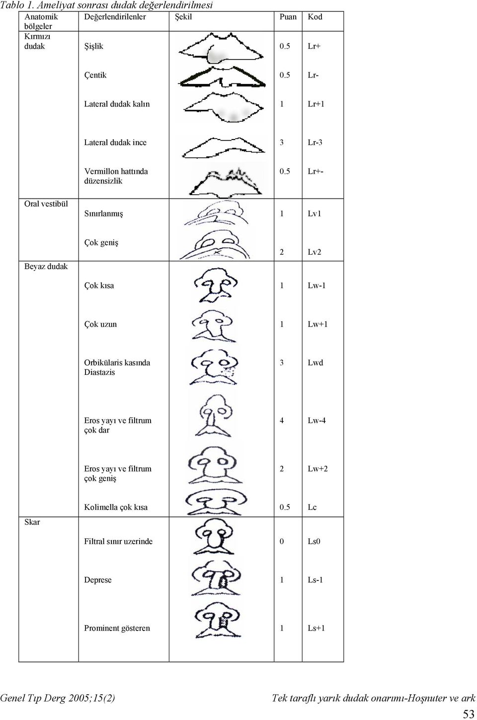 Lr- Lateral dudak kalın Lr+ Lateral dudak ince 3 Lr-3 Vermillon hattında düzensizlik Lr+- Oral vestibül Sınırlanmış Lv Çok