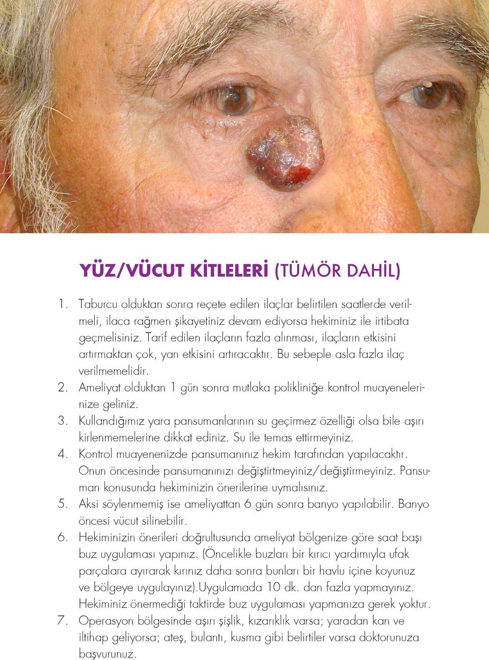 Ameliyat olduktan 1 gün sonra mutlaka polikliniğe kontrol muayenelerinize geliniz. 3. Kullandığımız yara pansumanlarının su geçirmez özelliği olsa bile aşırı kirlenmemelerine dikkat ediniz.