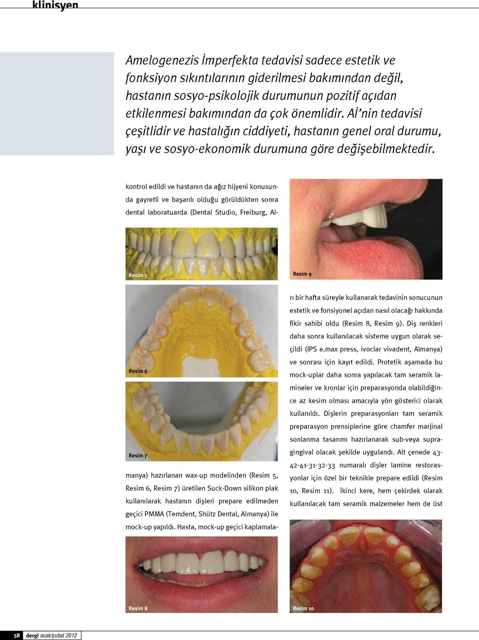 Resim 5 Resim 9 kontrol edildi ve hastanın da ağız hijyeni konusunda gayretli ve başarılı olduğu görüldükten sonra dental laboratuarda (Dental Studio, Freiburg, Al- Resim 6 Resim 7 manya) hazırlanan
