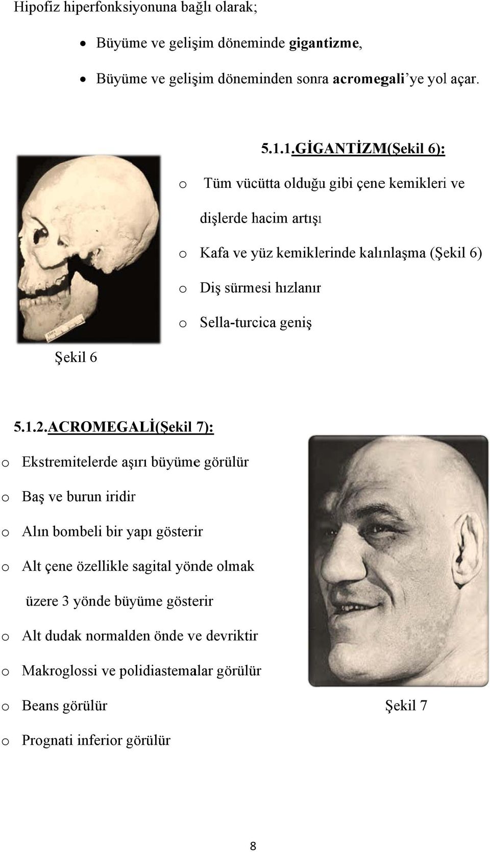 Sella-turcica geniş Şekil 6 5.1.2.