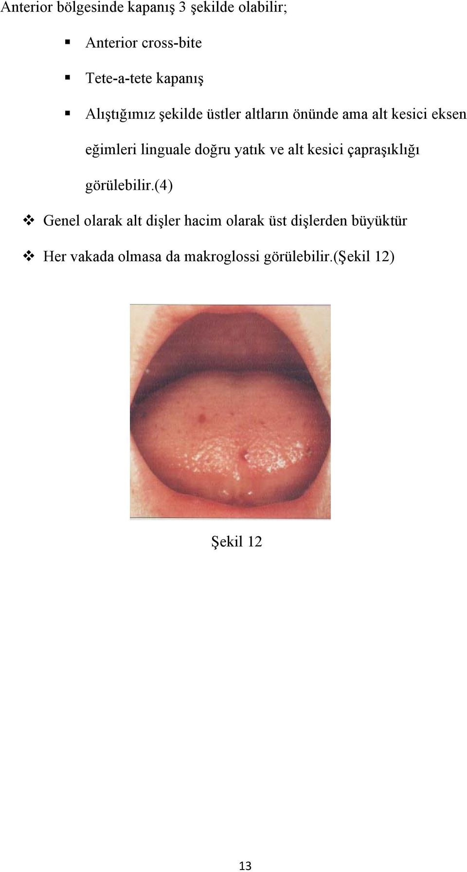 yatık ve alt kesici çapraşıklığı görülebilir.