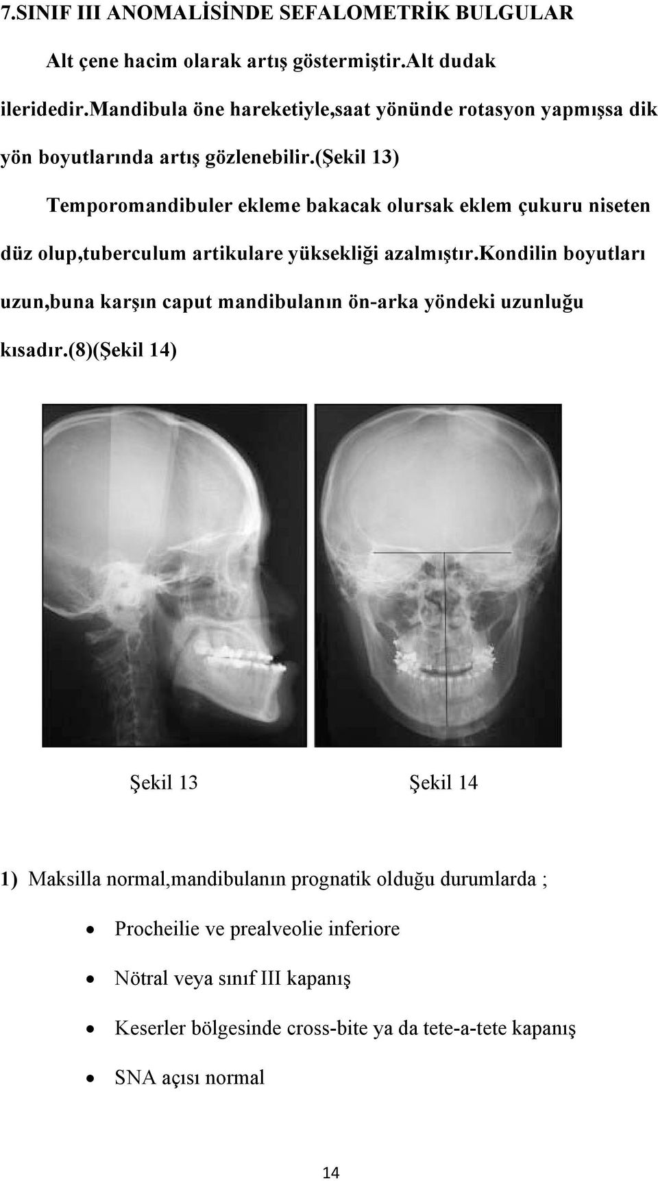 (şekil 13) Temporomandibuler ekleme bakacak olursak eklem çukuru niseten düz olup,tuberculum artikulare yüksekliği azalmıştır.