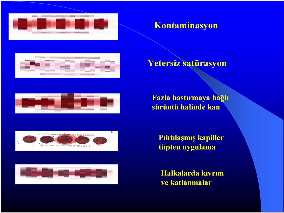 halinde kan Pıhtılaşmış kapiller