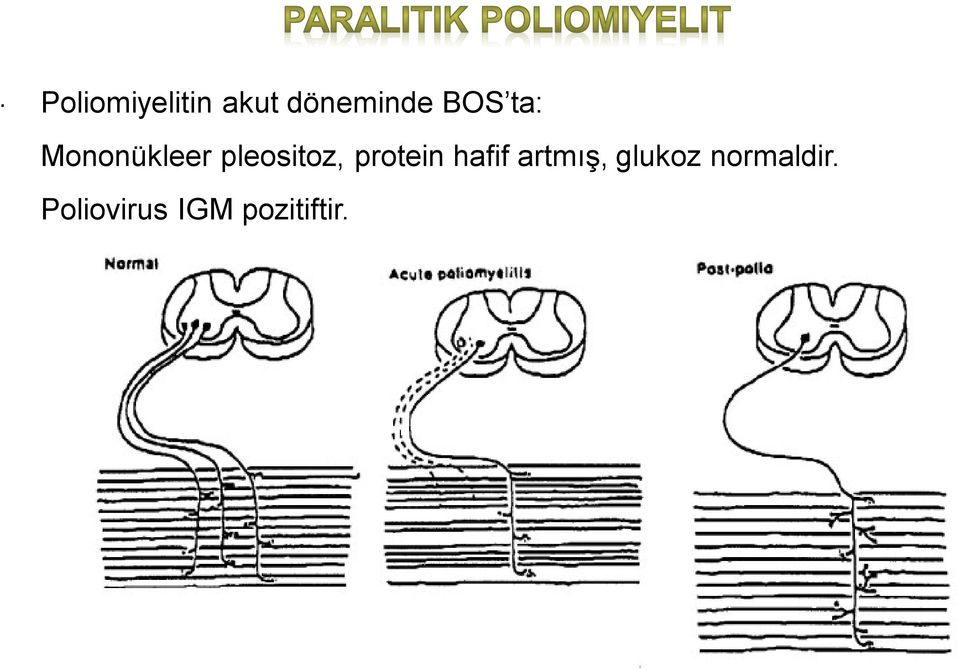 protein hafif artmış, glukoz