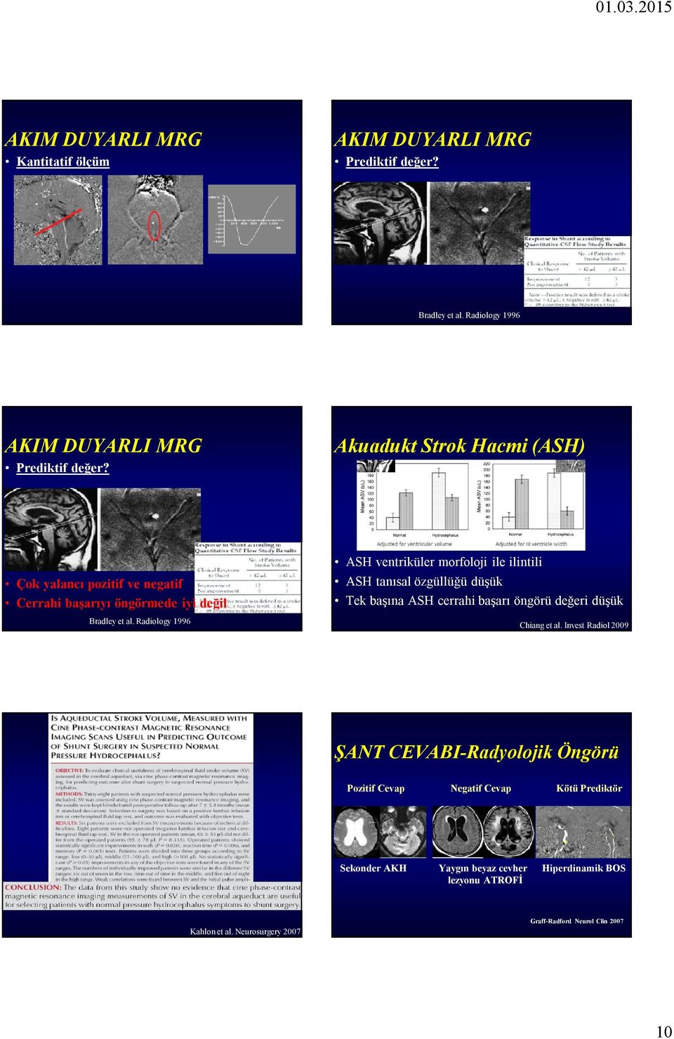 Radiology 1996 ASH ventriküler morfoloji ile ilintili ASH tanısal özgüllüğü düşük Tek başına ASH cerrahi başarı öngörü değeri düşük Chiang et al.