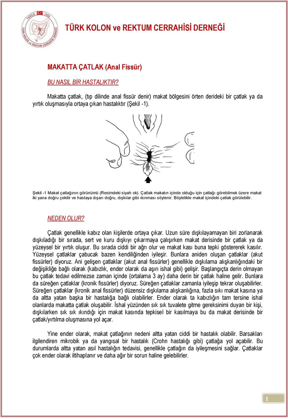 Şekil -1 Makat çatlağının görünümü (Resimdeki siyah ok).