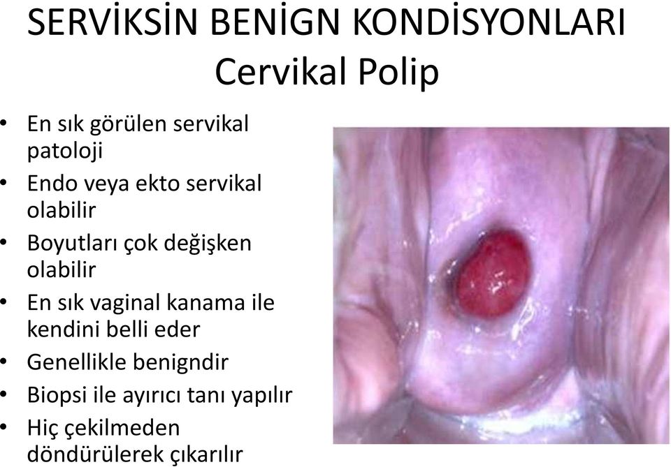 vaginal kanama ile kendini belli eder Genellikle benigndir Biopsi
