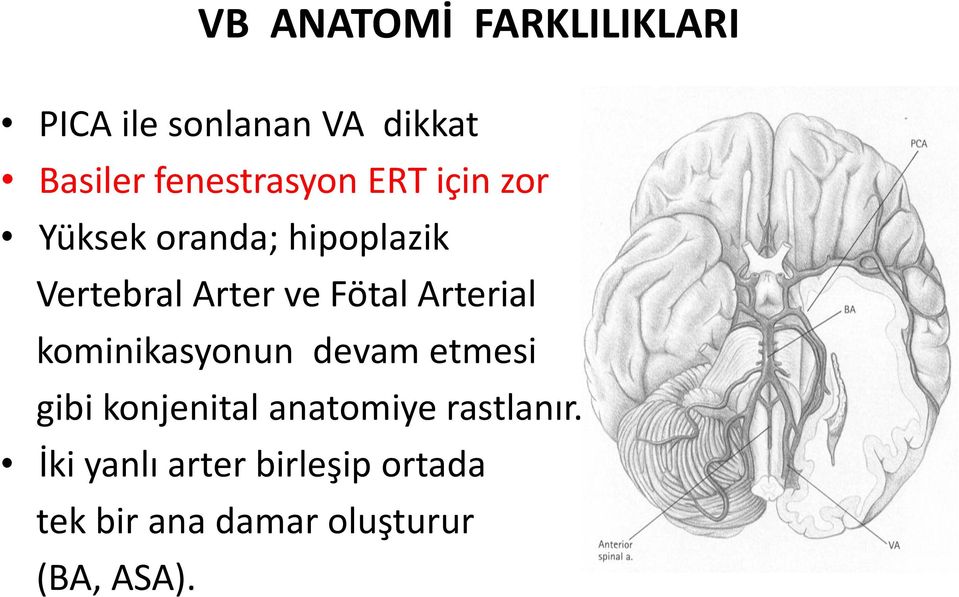 Fötal Arterial kominikasyonun devam etmesi gibi konjenital anatomiye
