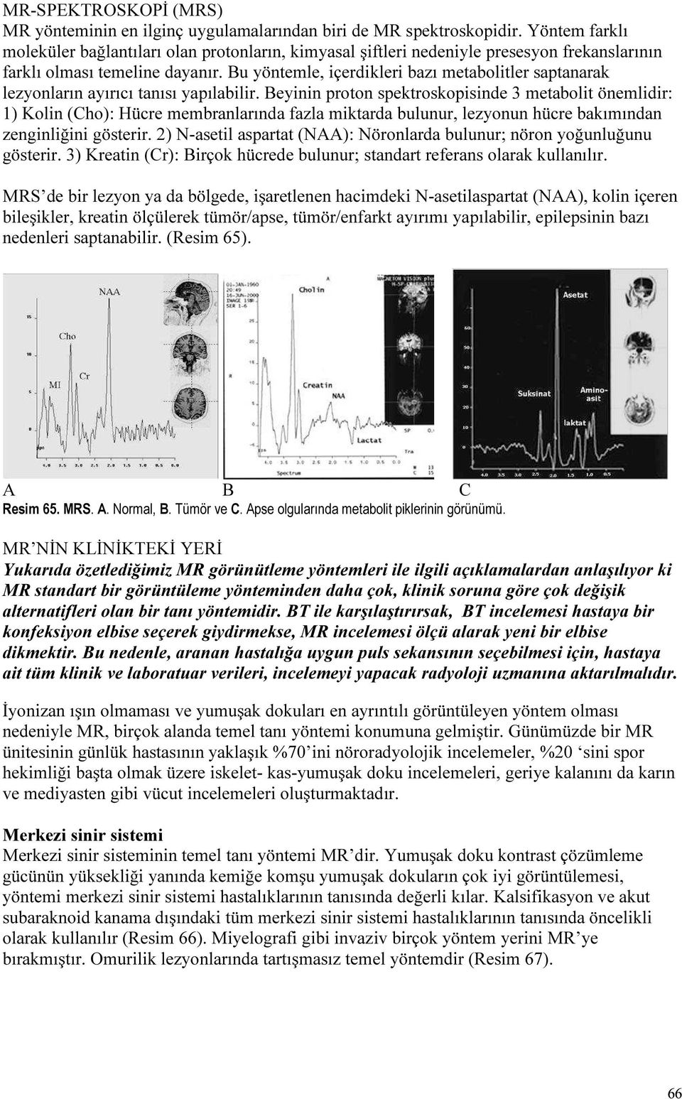 u yöntemle, içerdikleri bazı metabolitler saptanarak lezyonların ayırıcı tanısı yapılabilir.