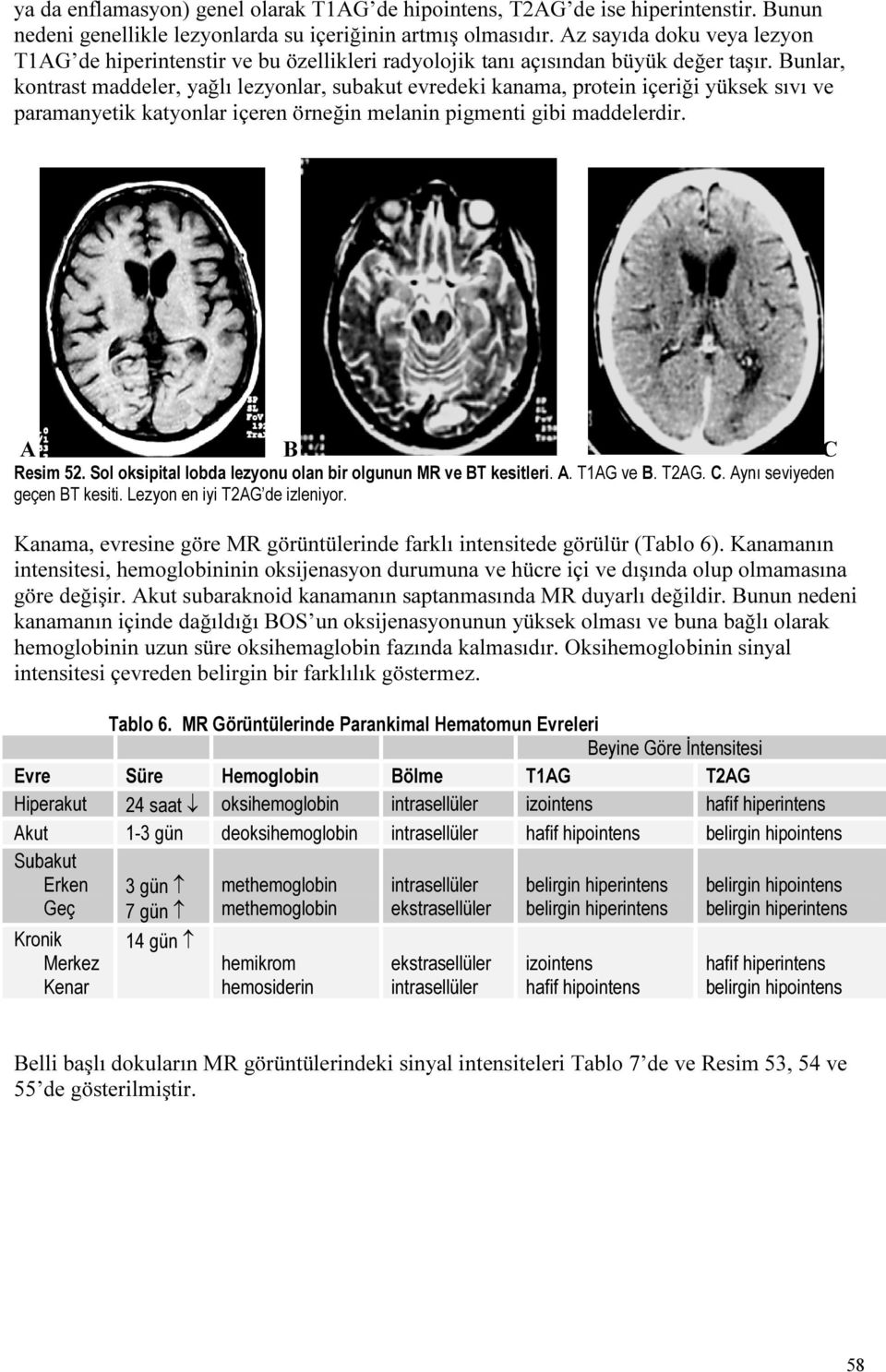 unlar, kontrast maddeler, yağlı lezyonlar, subakut evredeki kanama, protein içeriği yüksek sıvı ve paramanyetik katyonlar içeren örneğin melanin pigmenti gibi maddelerdir. C Resim 52.