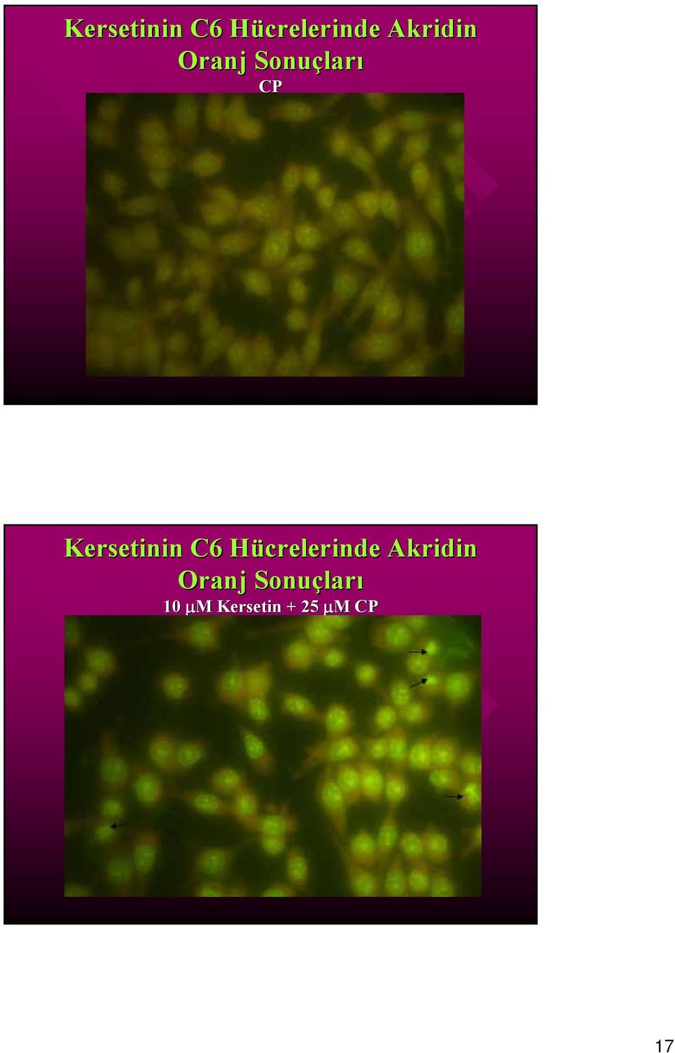 Hücrelerinde Akridin 1 μm